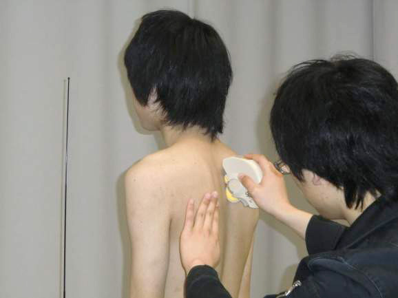 脊柱形状計測分析器